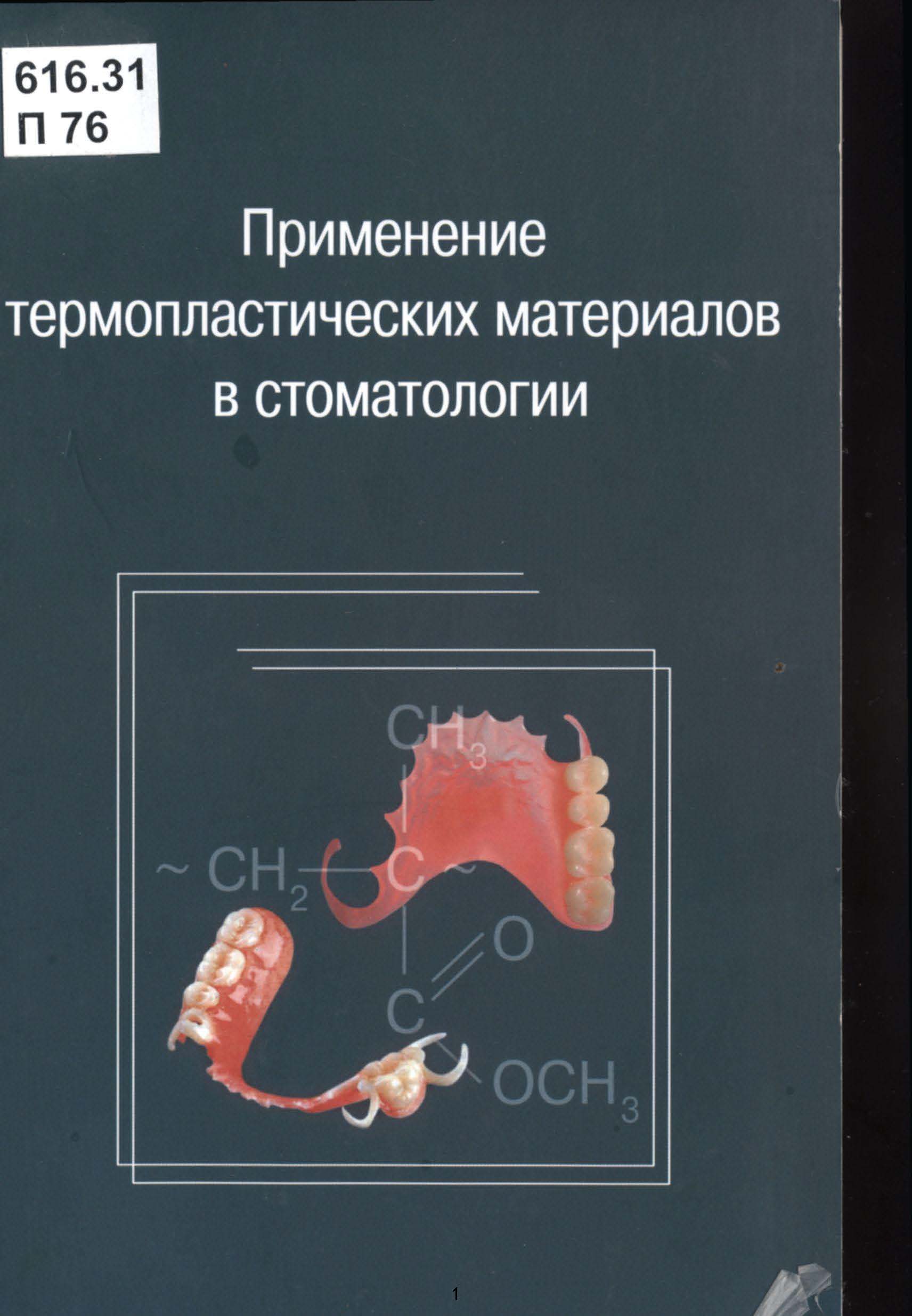 Применение термопластических материалов в стоматологии.