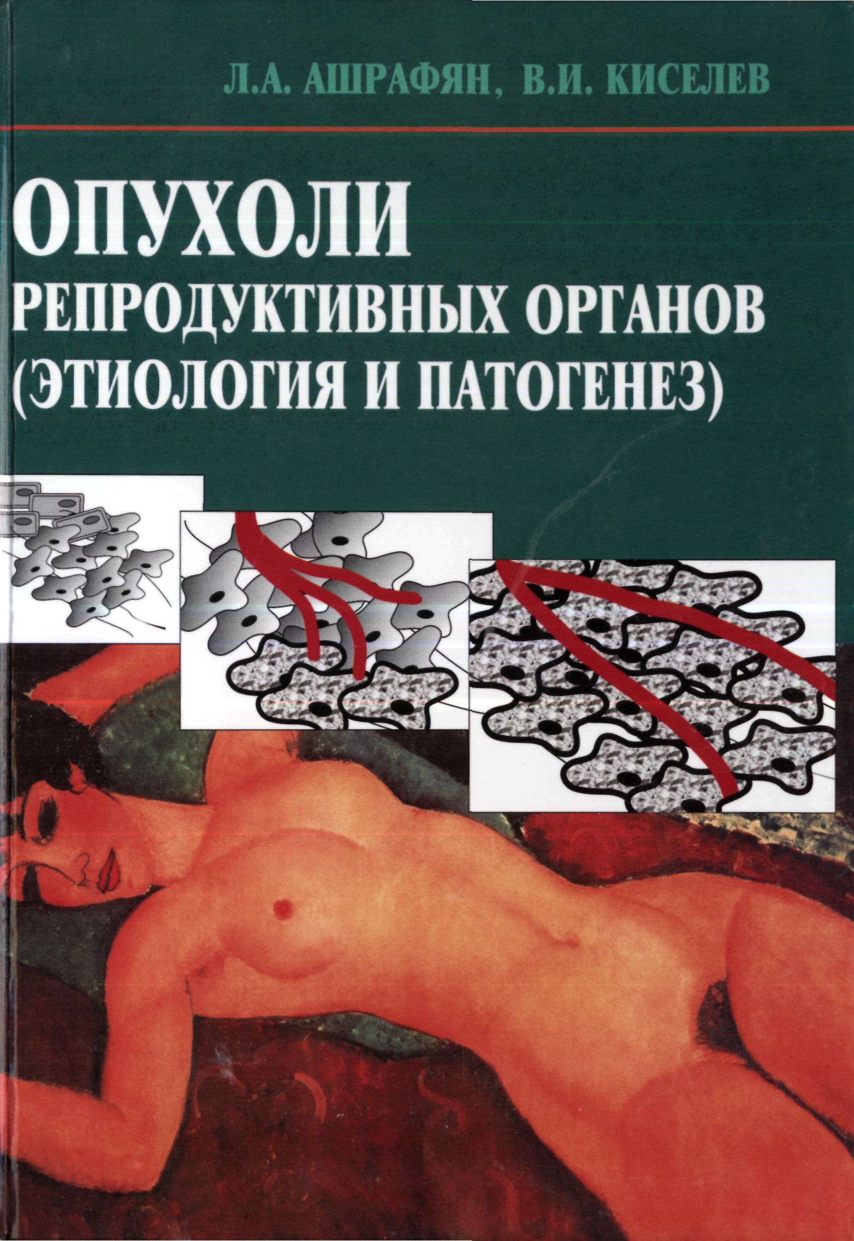ОПУХОЛИ РЕПРОДУКТИВНЫХ ОРГАНОВ