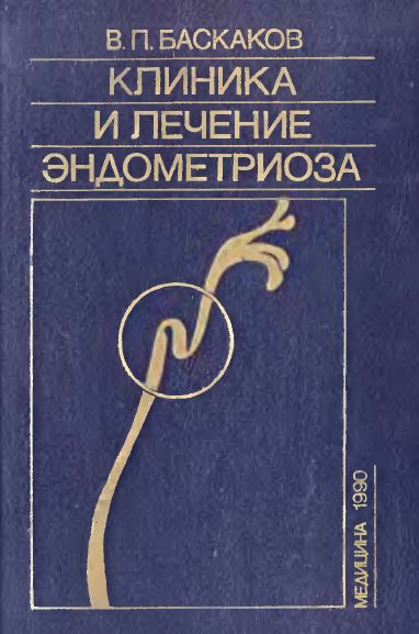 КЛИНИКА  И ЛЕЧЕНИЕ  ЭНДОМЕТРИОЗА