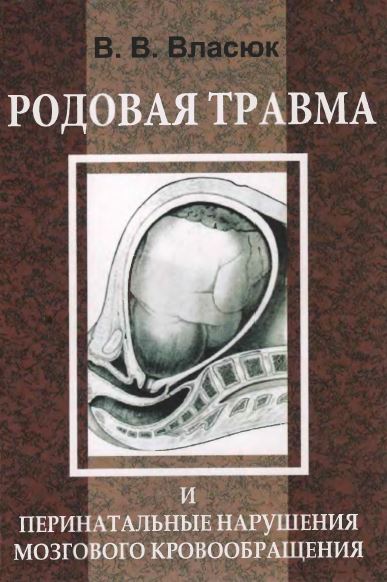 РОДОВАЯ ТРАВМА