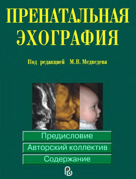 ПРЕНАТАЛЬНАЯ  ЭХОГРАФИЯ