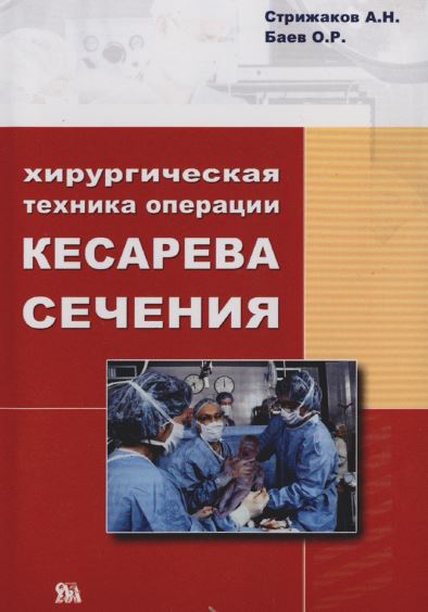 КЕСАРЕВО СЕЧЕНИЕ. ОТ ДРЕВНОСТИ ДО НАШИХ ДНЕЙ