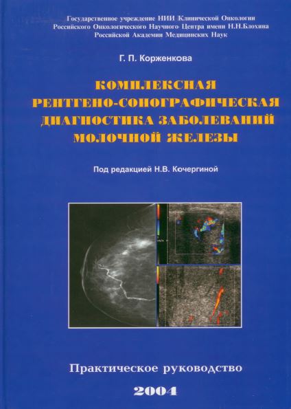 КОМПЛЕКСНАЯ  РЕНТГЕНО-СОНОГРАФИЧЕСКАЯ  ДИАГНОСТИКА ЗАБОЛЕВАНИЙ  МОЛОЧНОЙ ЖЕЛЕЗЫ