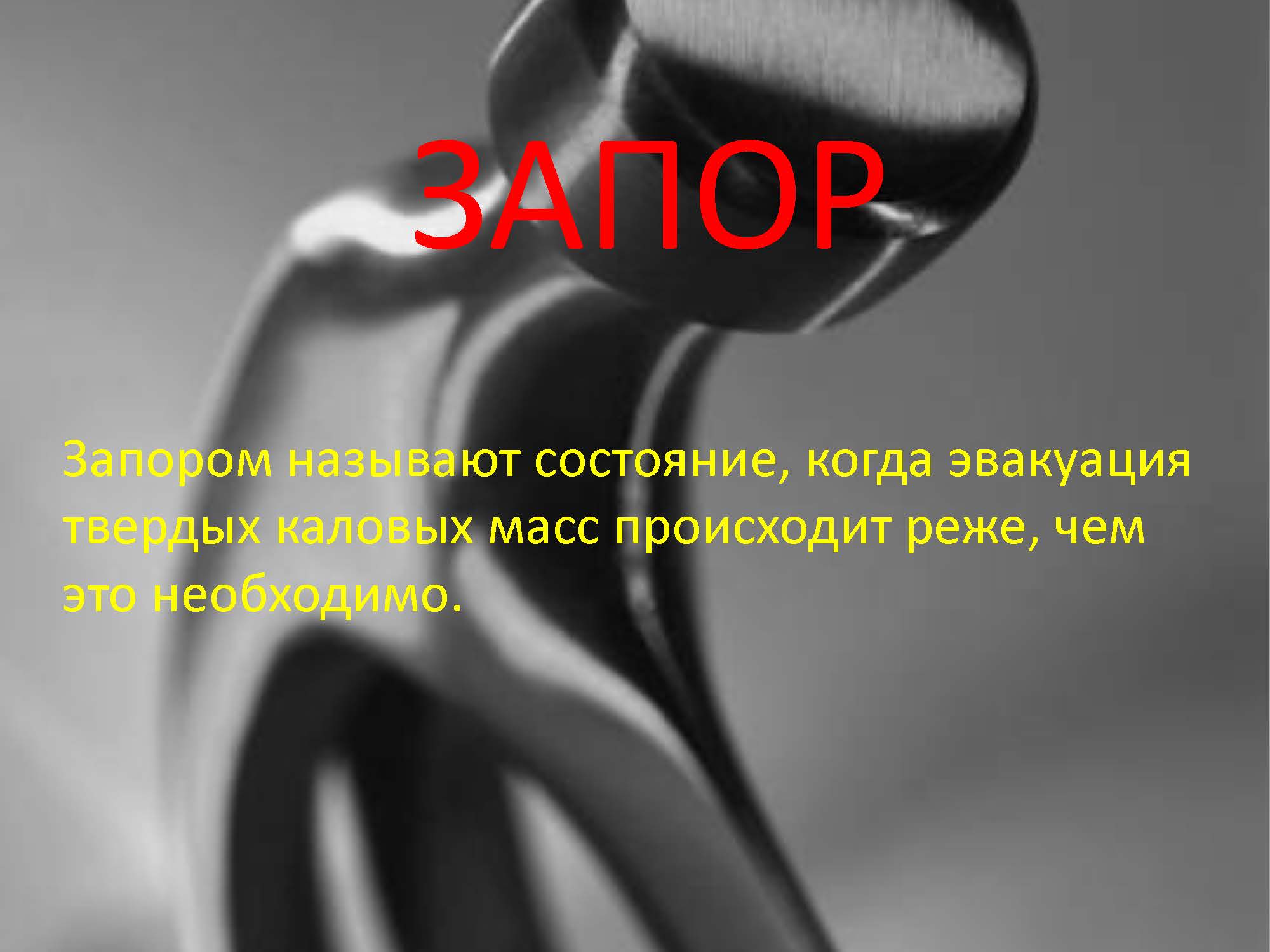 ЗАПОР